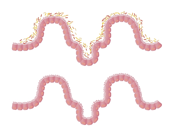 Microbiota sulla bocca di tutti!