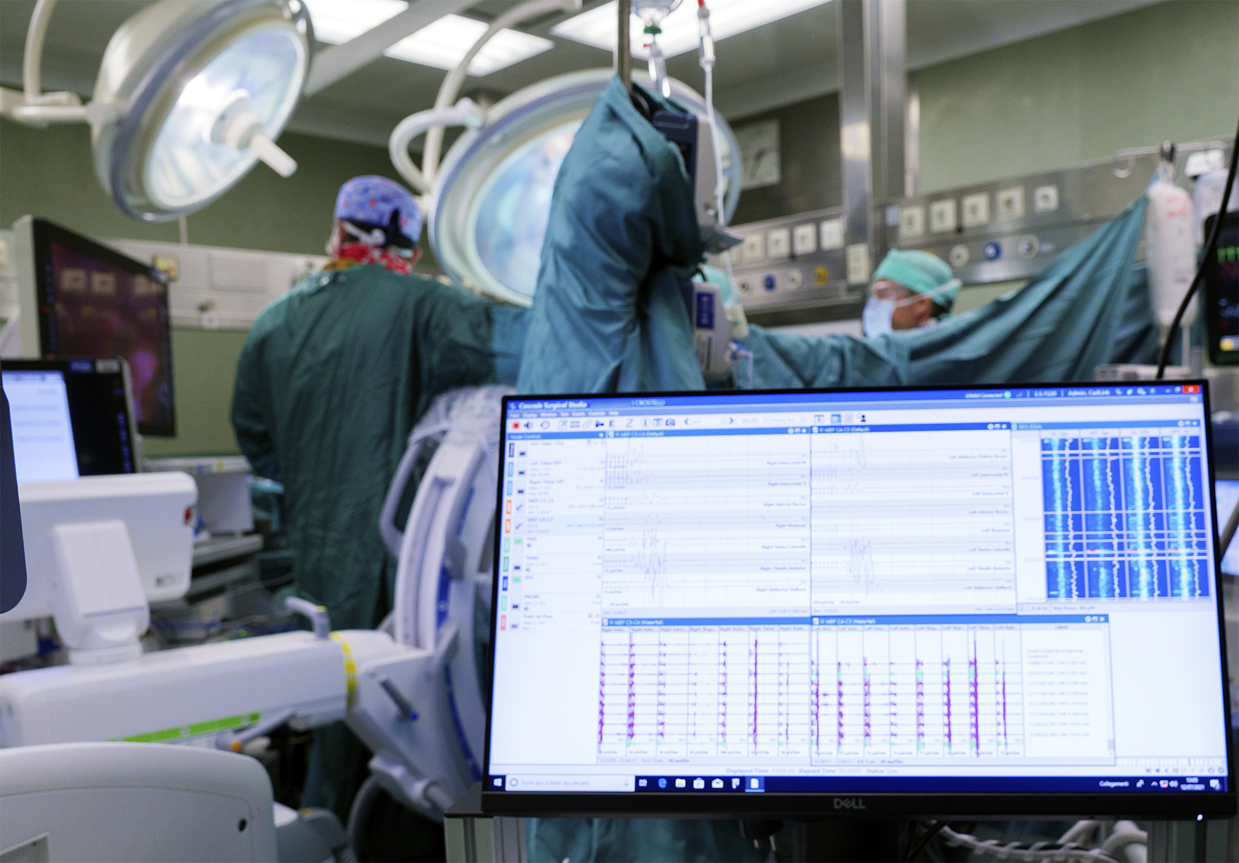BAMBINO GESÙ: NUOVA STRATEGIA CHIRURGICA INTEGRATA PER RIMUOVERE UN COMPLESSO NEUROBLASTOMA